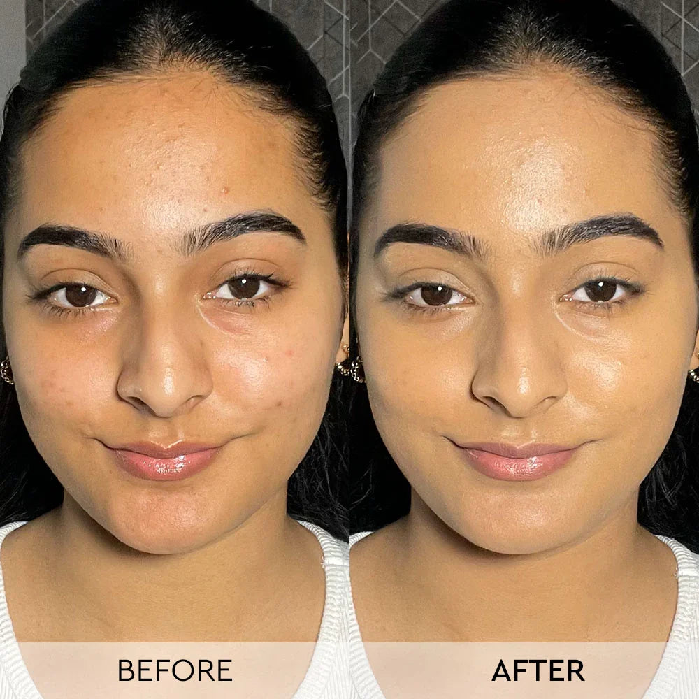 Texture Corrector BB Cream – Hydrating BB Cream with SPF, Pore Blur & Skin Correction – Deep Hydration, SPF Protection, Pore Blur, Even Tone
