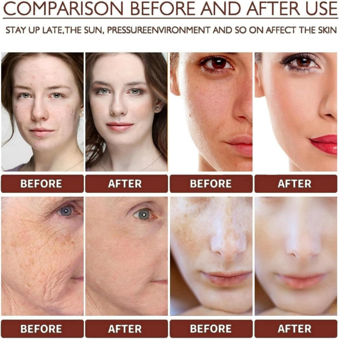 Dr. Melaxin Ultimate Skin Deal | Cyano Pink Spicule Serum + Picotonic Shot Ampoule | Pore Tightening, Anti-Aging & Anti-Pigmentation Duo