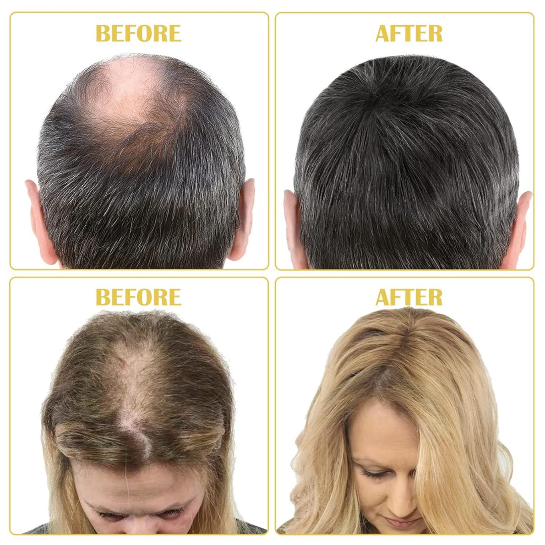 Dr. Alies Professional Red Onion & Black Seed Oil Hair Oil – 100% Natural – Stops Hair Fall, Strengthens Roots, Prevents Premature Greying – With Castor Oil – For Split Ends, Thinning Hair & Scalp Health