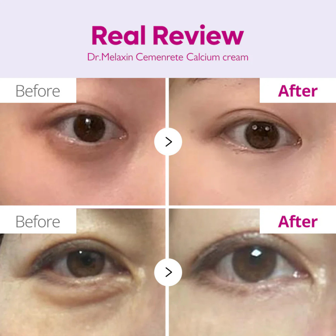 Calcium & Collagen Balm Stick | Remove Wrinkles, Smile Lines & Gives Hydration & Glow