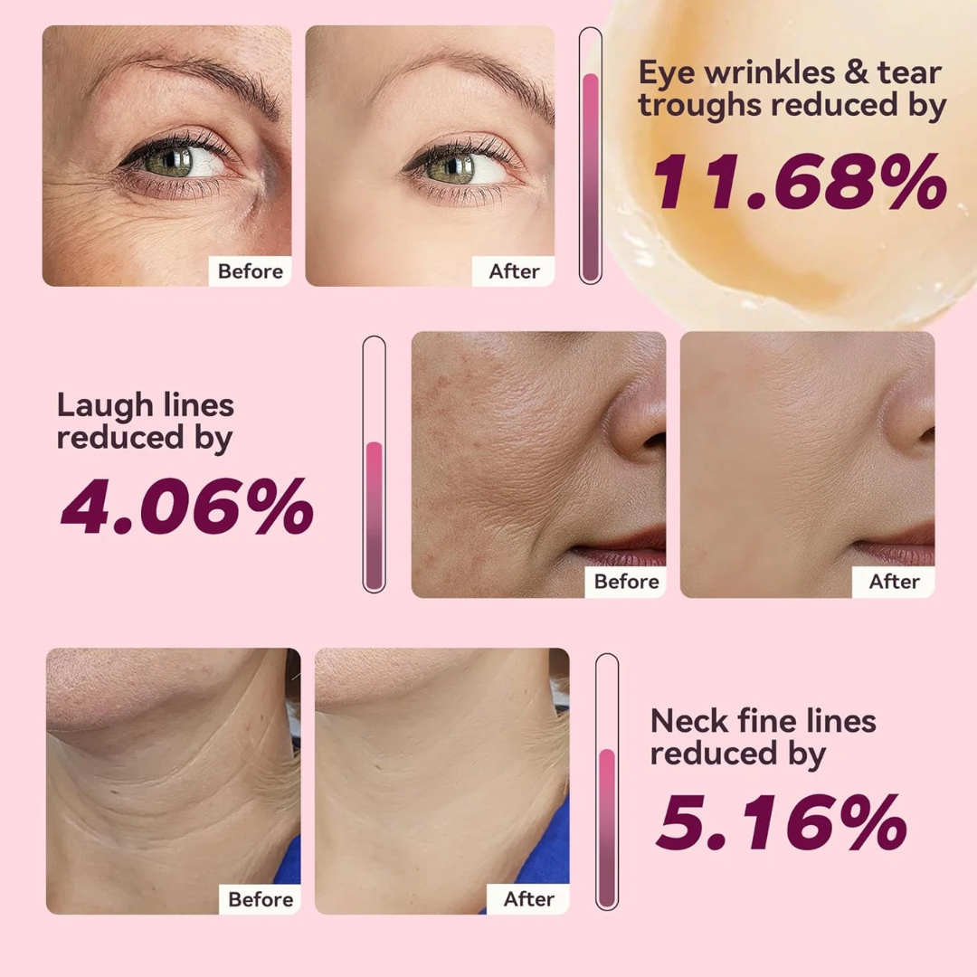Calcium & Collagen Balm Stick | Remove Wrinkles, Smile Lines & Gives Hydration & Glow