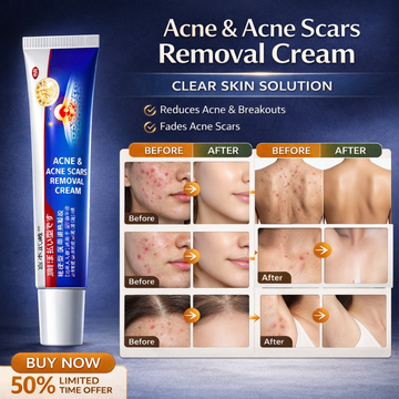 Acne & Acne Scars Removal Cream | Salicylic Acid + Niacinamide + Hyaluronic Acid + Tea Tree | Reduces Breakouts, Fades Scars & Evens Skin Tone