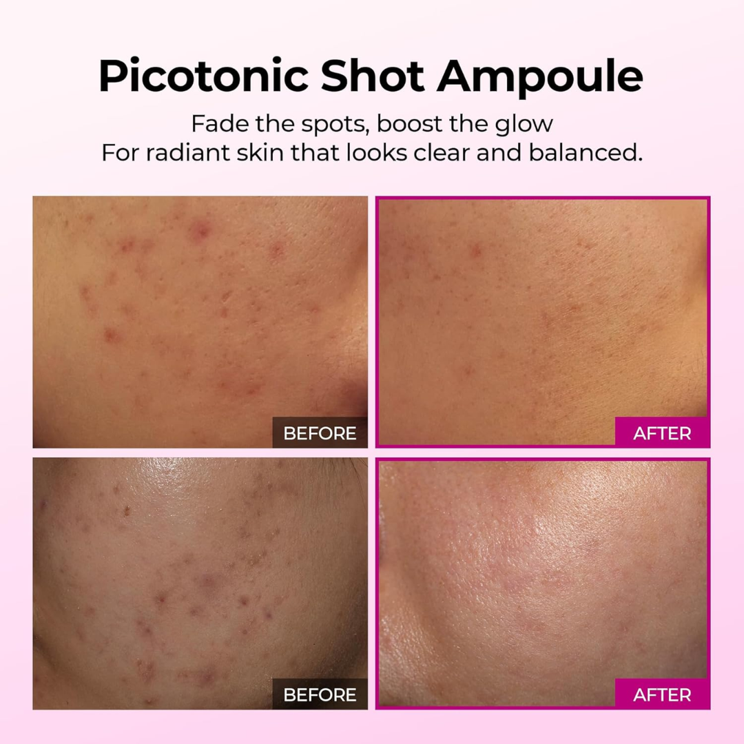 Dr. Melaxin Ultimate Skin Deal | Cyano Pink Spicule Serum + Picotonic Shot Ampoule | Pore Tightening, Anti-Aging & Anti-Pigmentation Duo