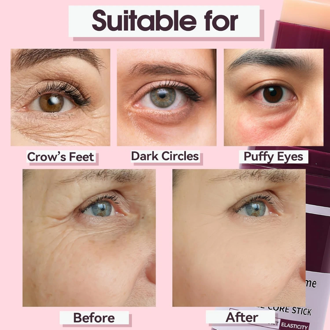 Calcium & Collagen Balm Stick | Remove Wrinkles, Smile Lines & Gives Hydration & Glow