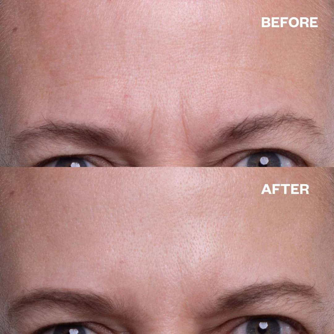 Calcium & Collagen Balm Stick | Remove Wrinkles, Smile Lines & Gives Hydration & Glow