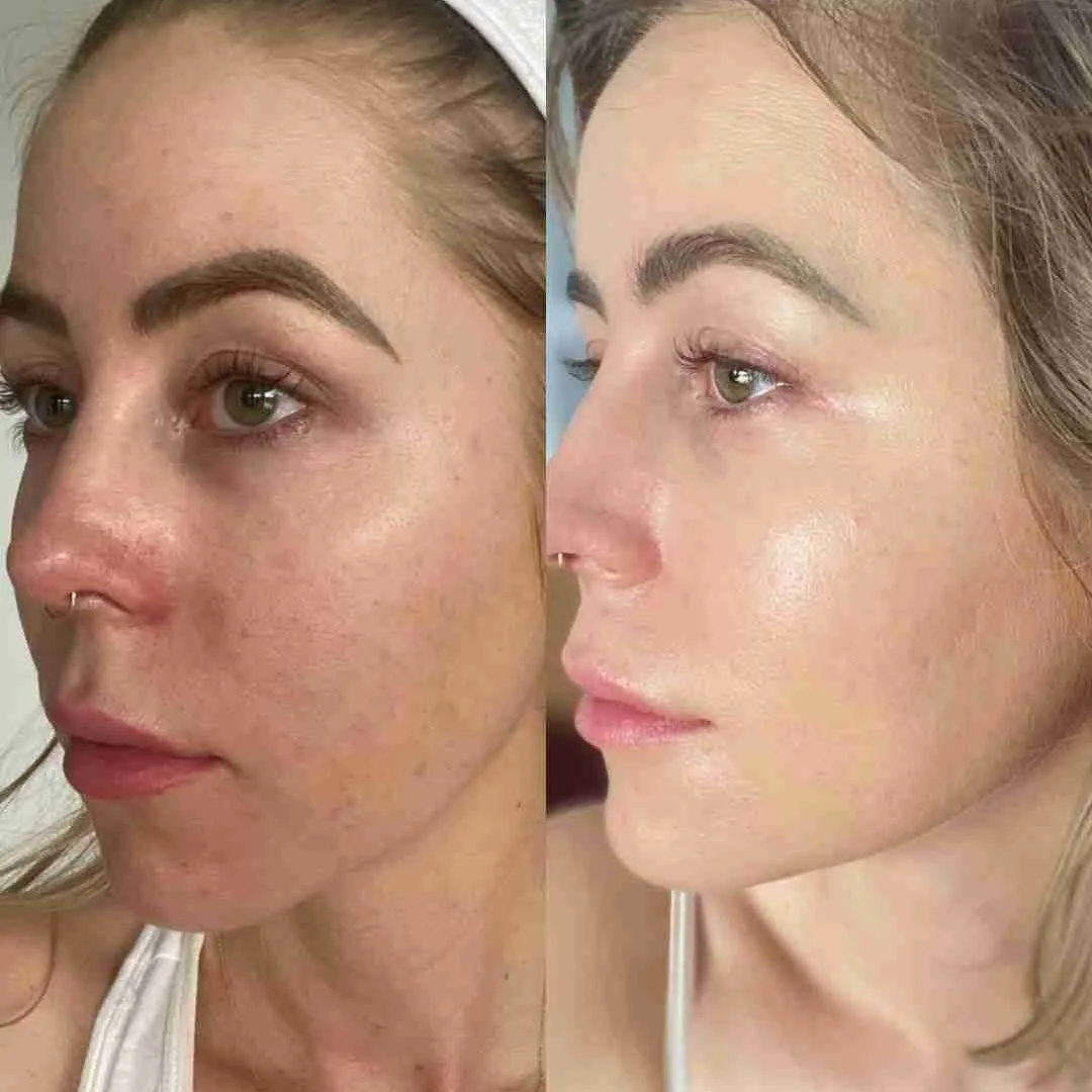 Dr. Melaxin Ultimate Skin Deal | Cyano Pink Spicule Serum + Picotonic Shot Ampoule | Pore Tightening, Anti-Aging & Anti-Pigmentation Duo