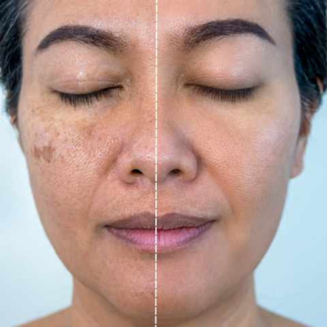 Dr. Melaxin Ultimate Skin Deal | Cyano Pink Spicule Serum + Picotonic Shot Ampoule | Pore Tightening, Anti-Aging & Anti-Pigmentation Duo