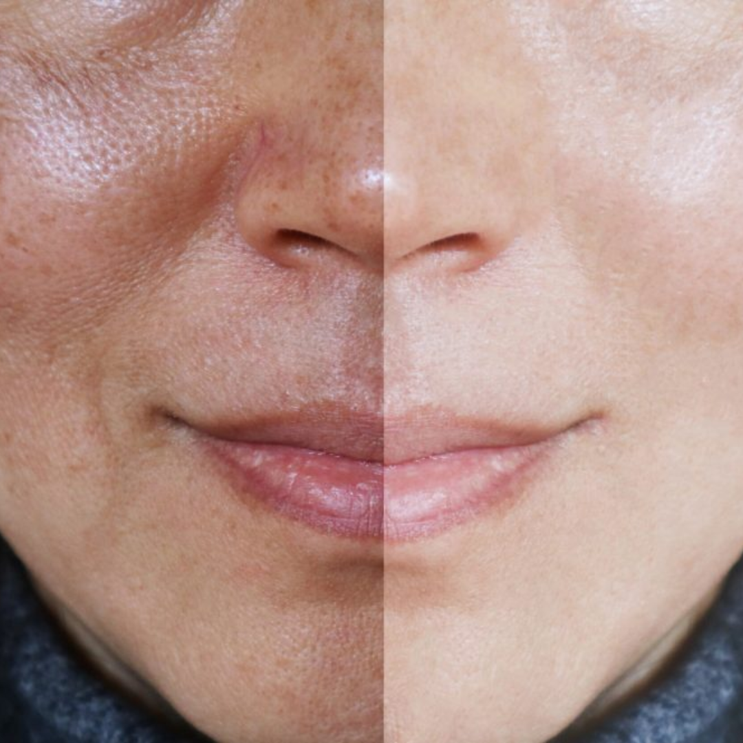 Dr. Melaxin Ultimate Skin Deal | Cyano Pink Spicule Serum + Picotonic Shot Ampoule | Pore Tightening, Anti-Aging & Anti-Pigmentation Duo