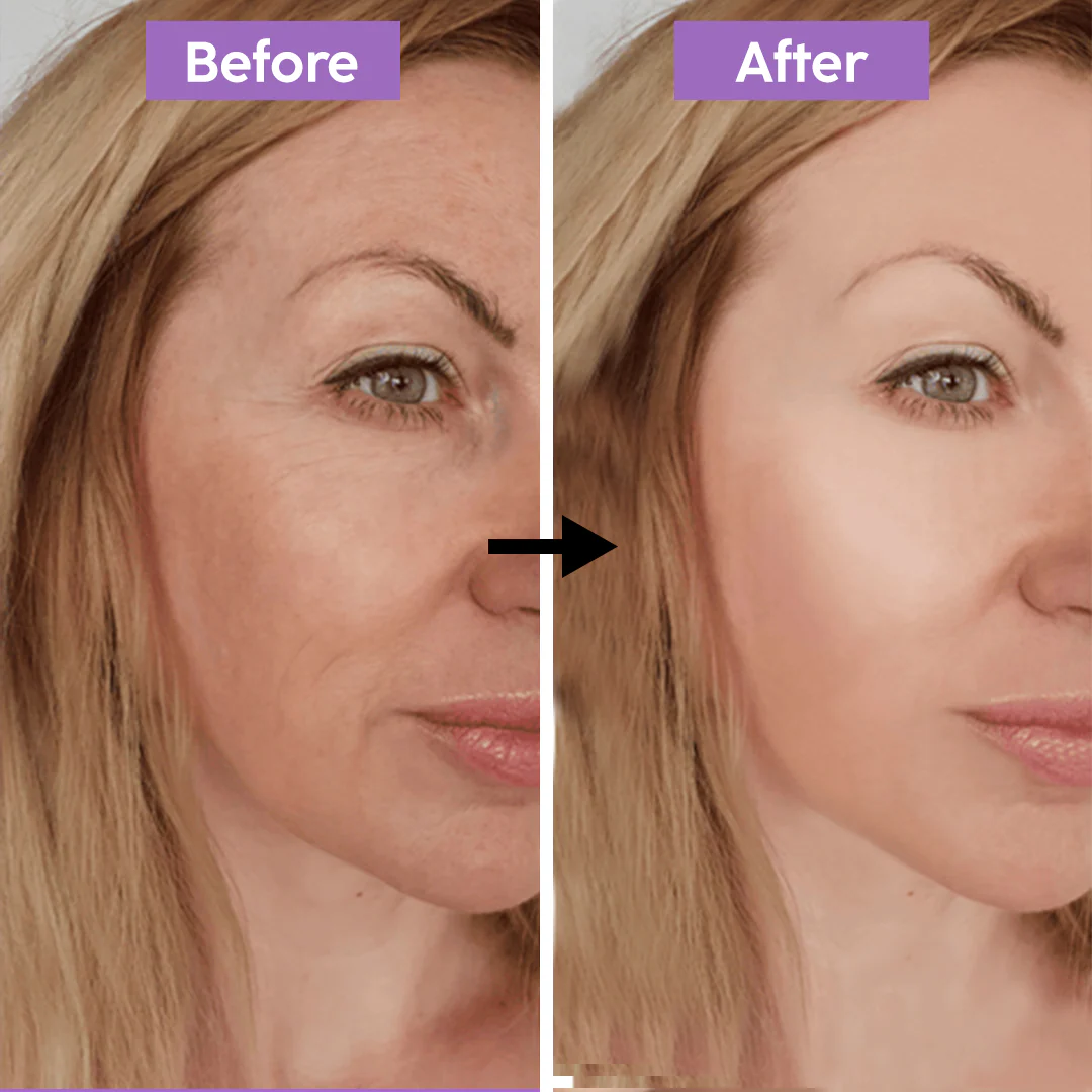 Dr. Melaxin Ultimate Skin Deal | Cyano Pink Spicule Serum + Picotonic Shot Ampoule | Pore Tightening, Anti-Aging & Anti-Pigmentation Duo