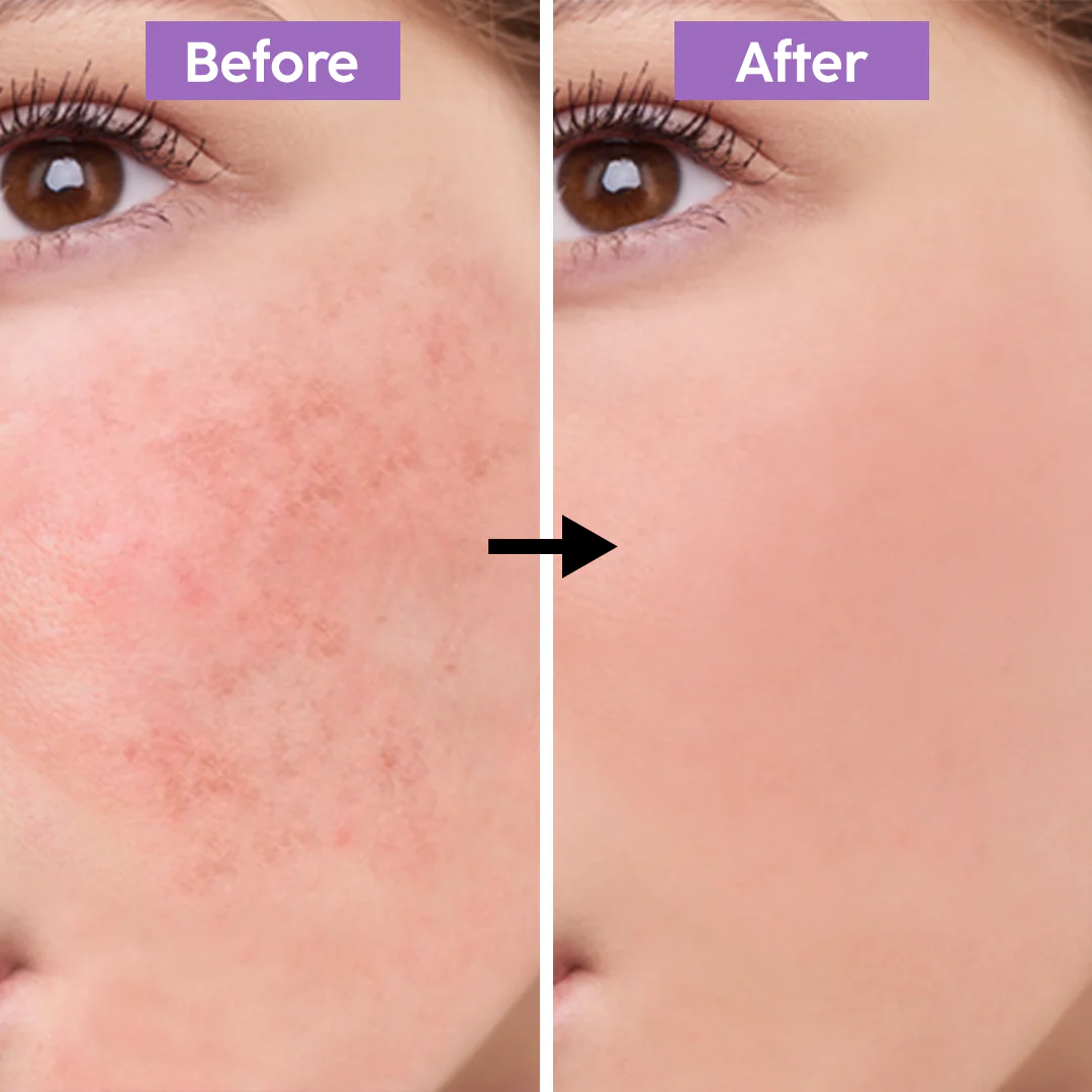 Dr. Melaxin Ultimate Skin Deal | Cyano Pink Spicule Serum + Picotonic Shot Ampoule | Pore Tightening, Anti-Aging & Anti-Pigmentation Duo