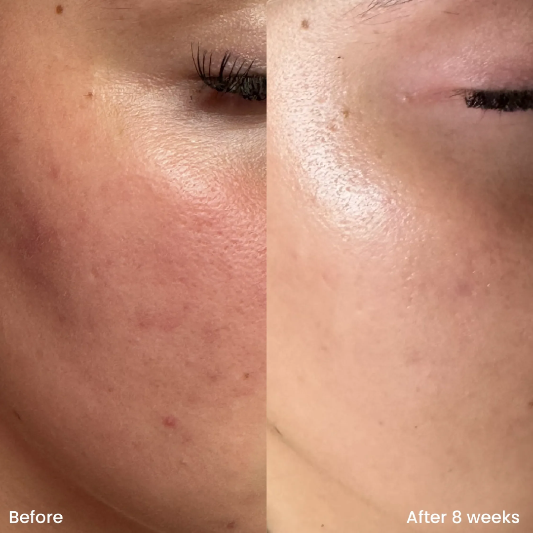 Dr. Melaxin Ultimate Skin Deal | Cyano Pink Spicule Serum + Picotonic Shot Ampoule | Pore Tightening, Anti-Aging & Anti-Pigmentation Duo