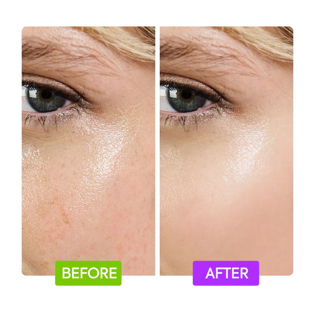 Dr. Melaxin Ultimate Skin Deal | Cyano Pink Spicule Serum + Picotonic Shot Ampoule | Pore Tightening, Anti-Aging & Anti-Pigmentation Duo