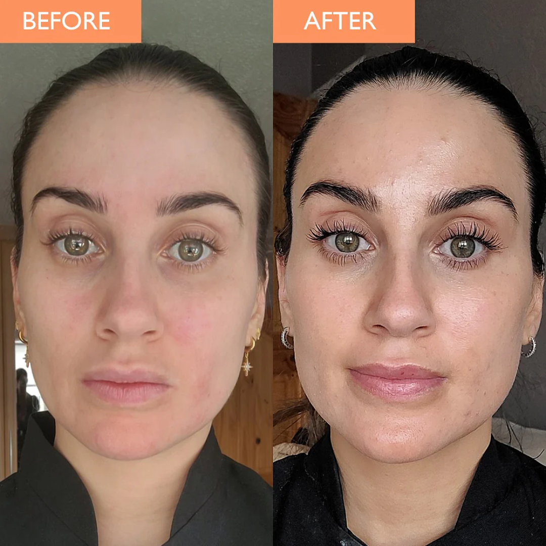 Dr. Melaxin Ultimate Skin Deal | Cyano Pink Spicule Serum + Picotonic Shot Ampoule | Pore Tightening, Anti-Aging & Anti-Pigmentation Duo