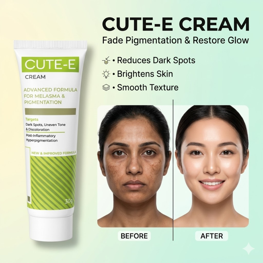 CUTE-E Cream Advanced Formula | For Melasma, Pigmentation & Dark Spots | Reduces Uneven Tone & Discoloration with Nature + Science Blend