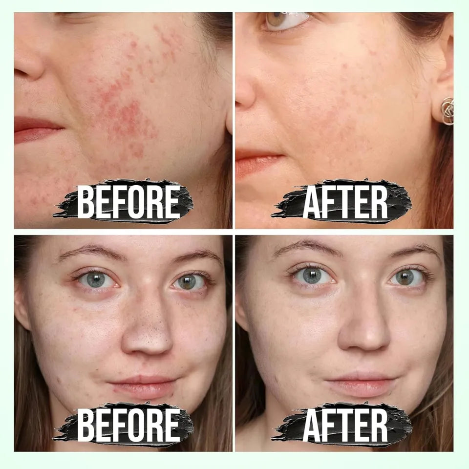 Medicube Kojic Acid Turmeric Overnight Mask - Brightening Peel Off Mask - Clinically Tested for Dull Skin
