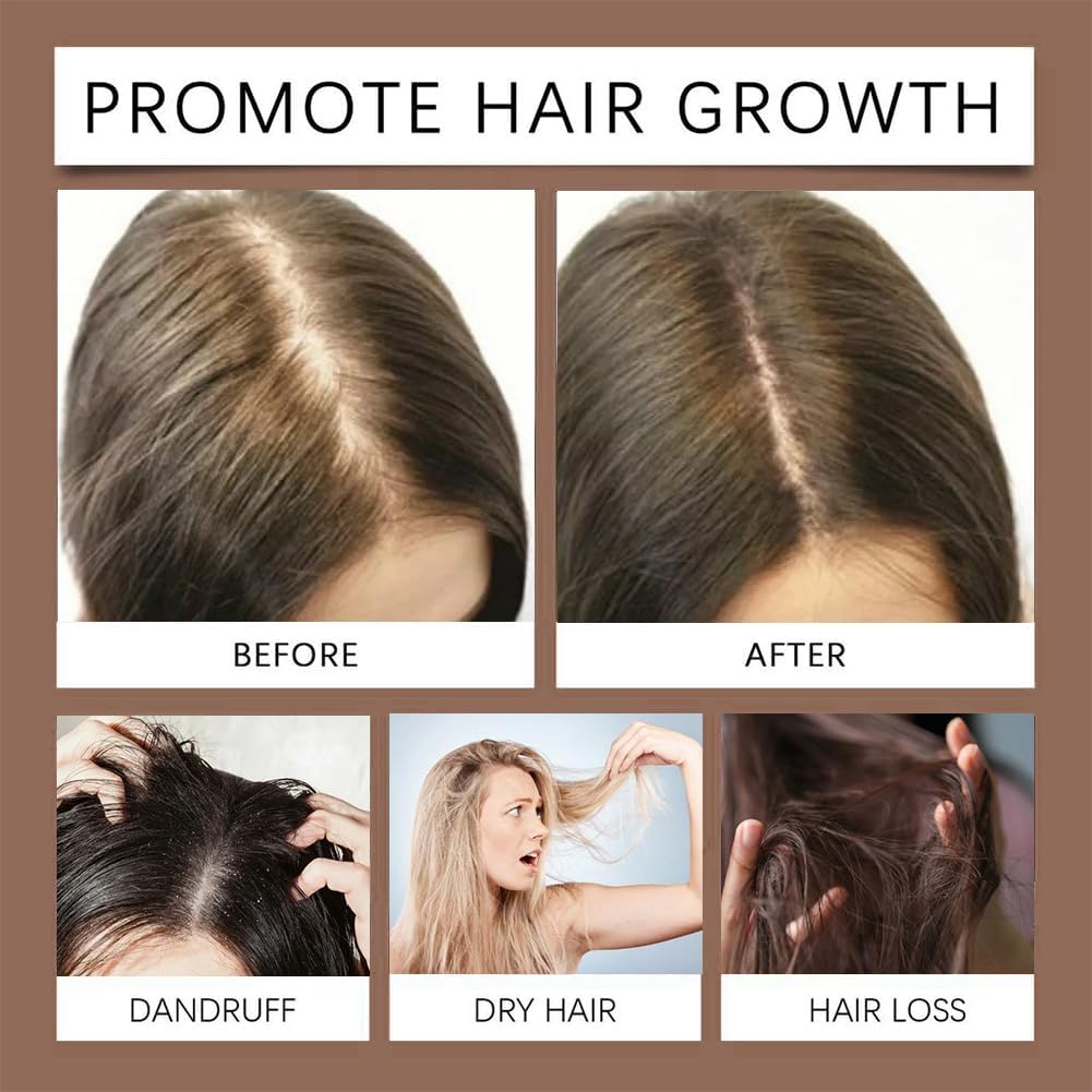 Dr. Alies Professional Red Onion & Black Seed Oil Hair Oil – 100% Natural – Stops Hair Fall, Strengthens Roots, Prevents Premature Greying – With Castor Oil – For Split Ends, Thinning Hair & Scalp Health