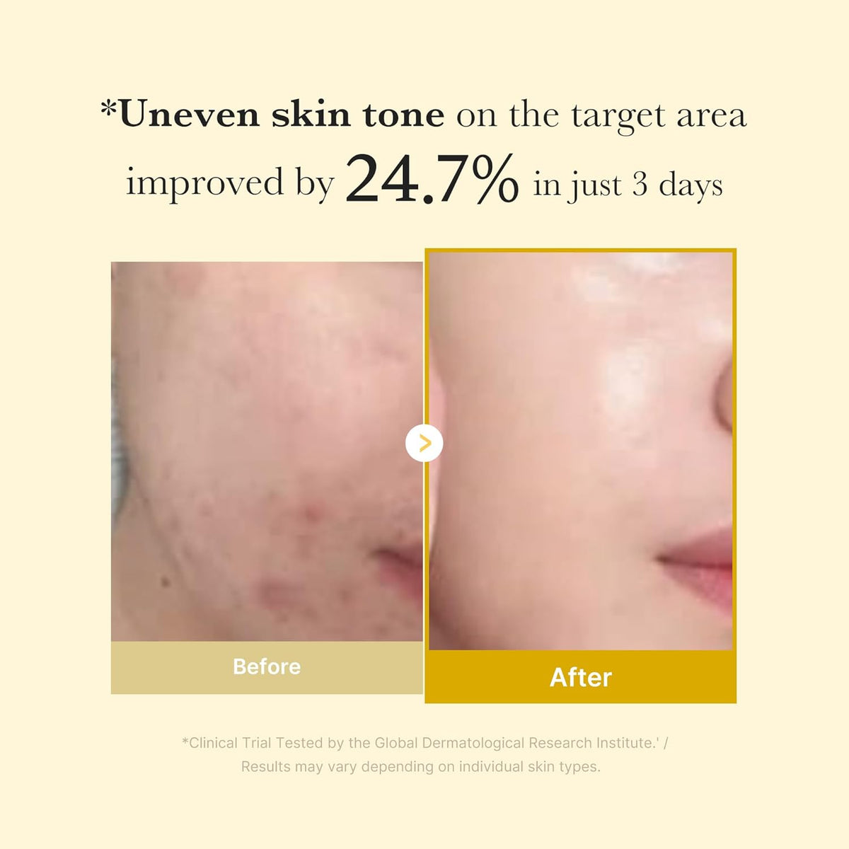 Medicube Kojic Acid Turmeric Overnight Mask - Brightening Peel Off Mask - Clinically Tested for Dull Skin