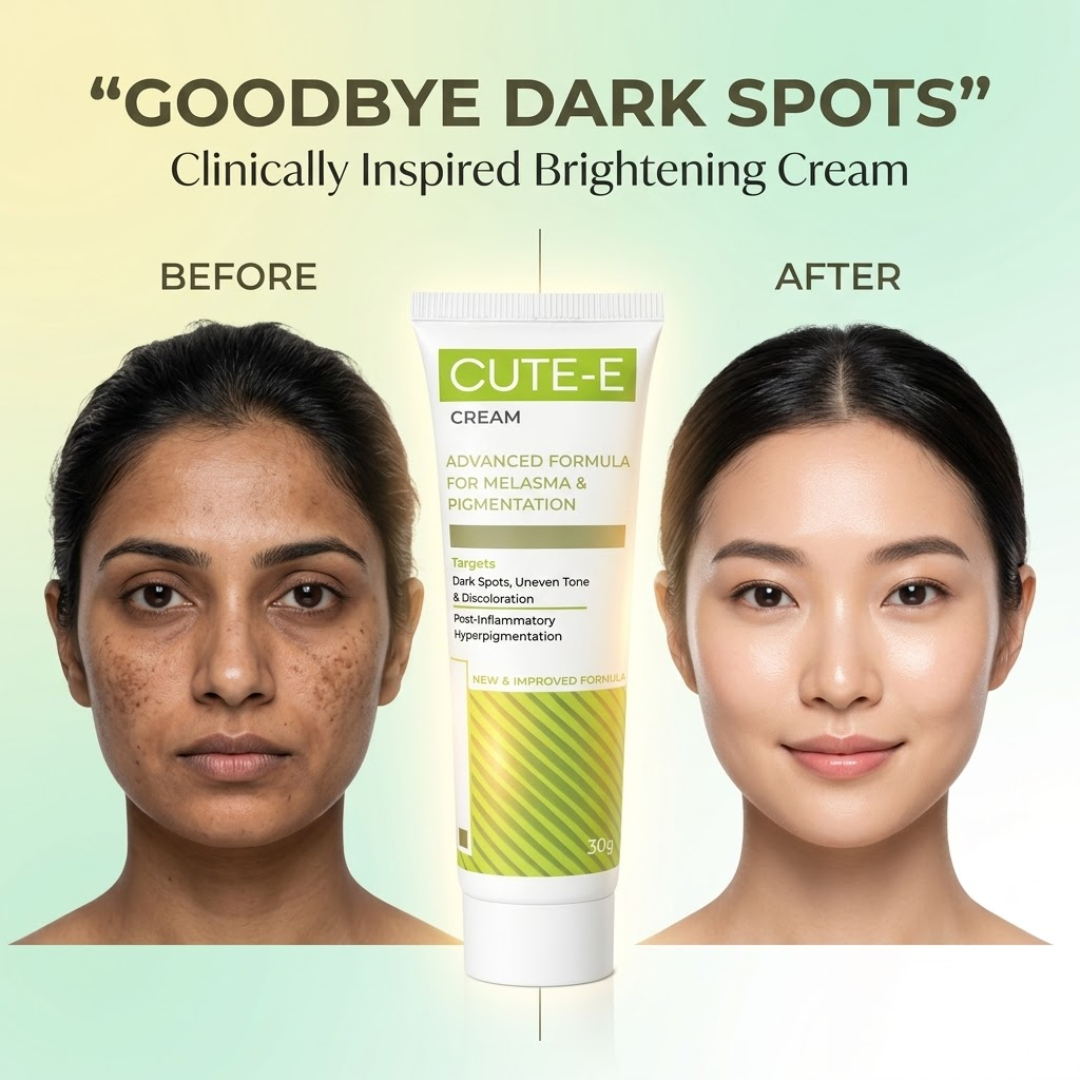 CUTE-E Cream Advanced Formula | For Melasma, Pigmentation & Dark Spots | Reduces Uneven Tone & Discoloration with Nature + Science Blend